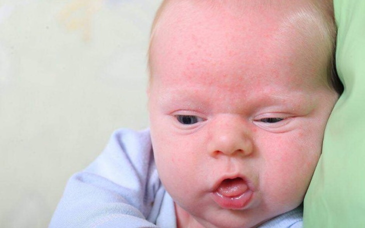 Zbiórka Dla Chorego krystianka - zdjęcie główne