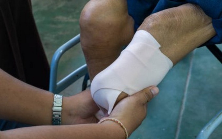 Zbiórka Zbiorka pomoc w zakupie protezy - zdjęcie główne