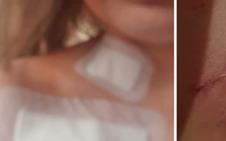 Zbiórka Leczenia dla mamy - zdjęcie główne