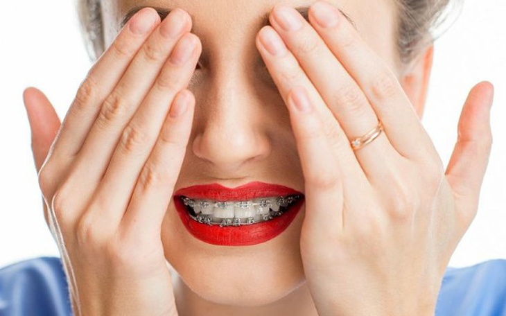 Zbiórka Aparat ortodontyczny = uśmiech - zdjęcie główne