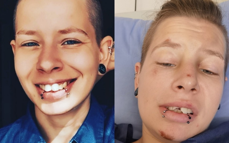 Zbiórka Pomóż odzyskać uśmiech - zdjęcie główne