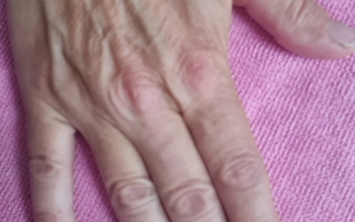 Zbiórka Sprawne ręce leczenie - zdjęcie główne