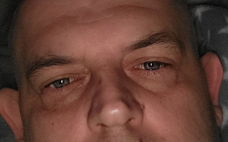 Zbliżenie na twarz mężczyzny z wyraźnymi rysami.