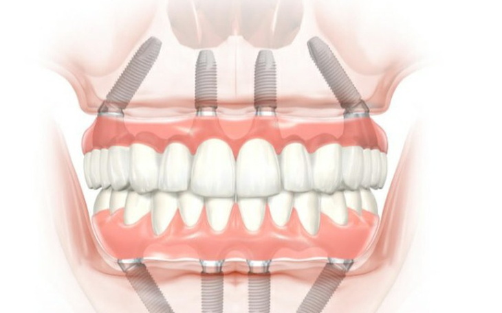 Zbiórka Zeby dla Anioła opiekuńczego zwi - zdjęcie główne