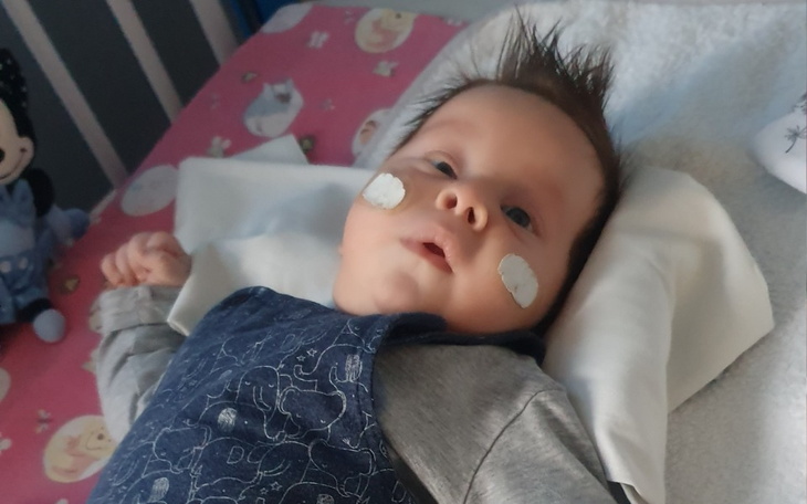 Zbiórka Ratunek dla oczka Marcelka - zdjęcie główne