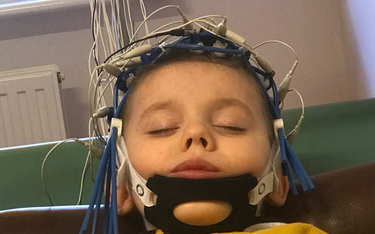 Chłopiec w specjalnym hełmie do badania EEG, relaksujący się.