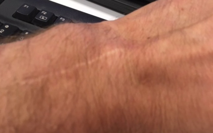 Zbiórka Leczenie komorkami macierzystymi - zdjęcie główne