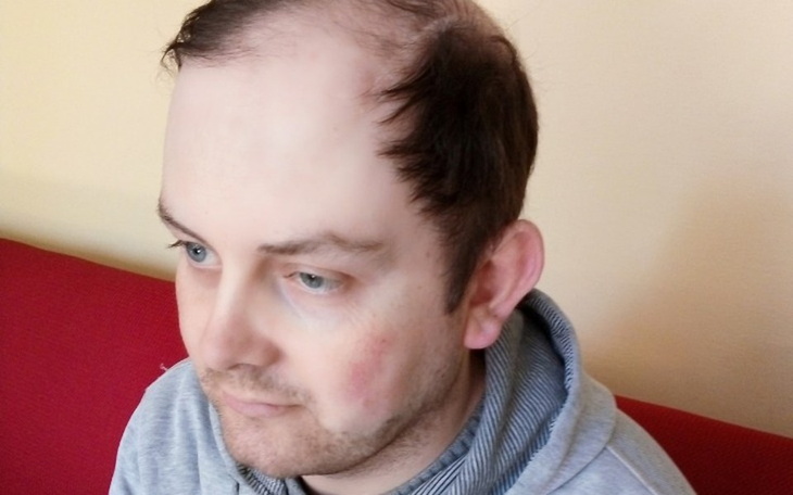 Zbiórka Rehabilitacja dla Łukasza. - zdjęcie główne