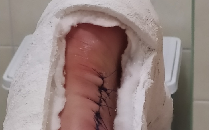 Zbiórka Pomoc w rehabilitacji i opłatac. - zdjęcie główne