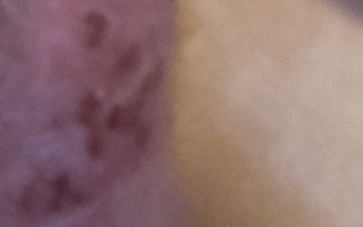 Zbiórka Uratujmy nogi Karoliny z Olsztyn - zdjęcie główne