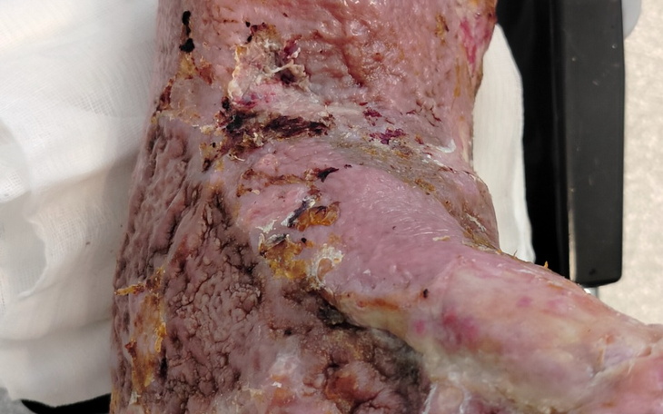 Zbiórka Na nowe nogi - zdjęcie główne