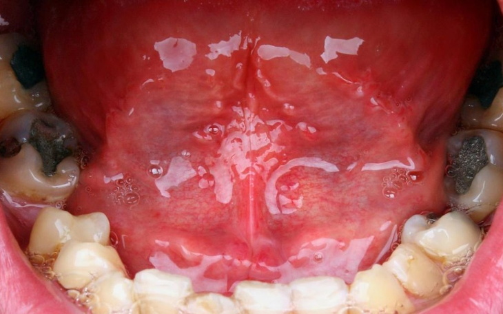 Zbiórka Naprawa ząbków, błagam o pomoc - zdjęcie główne