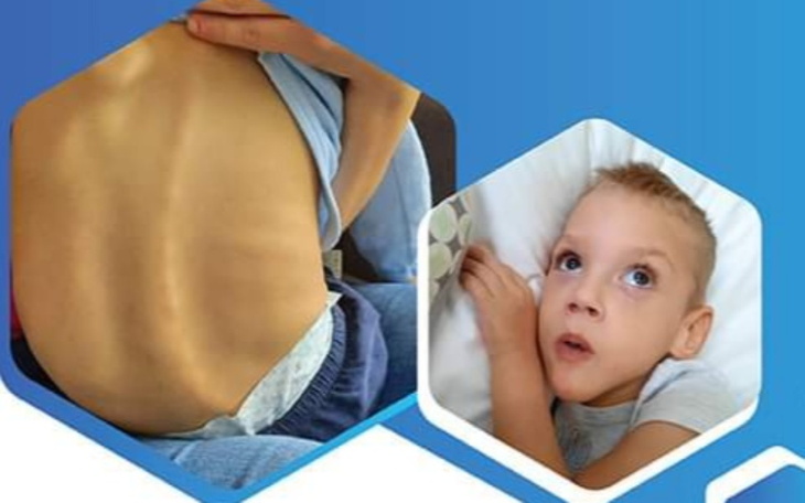 Zbiórka Pomóż mi wyjechać na turnus - zdjęcie główne