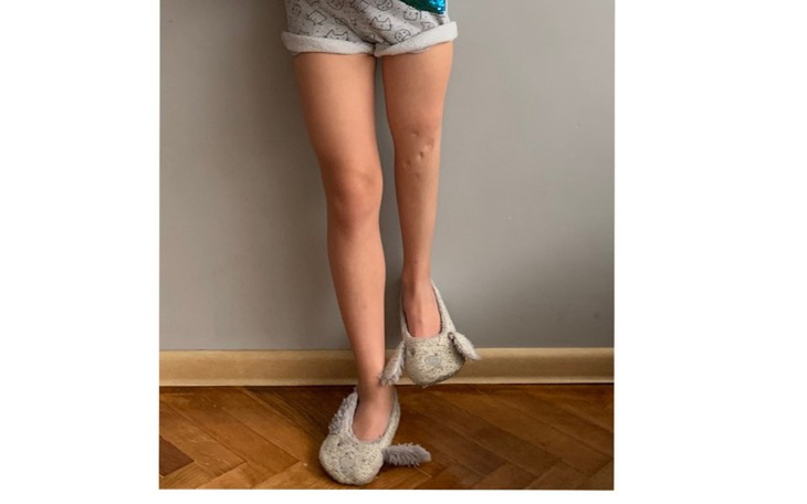 Zbiórka Operacja nóżki - zdjęcie główne