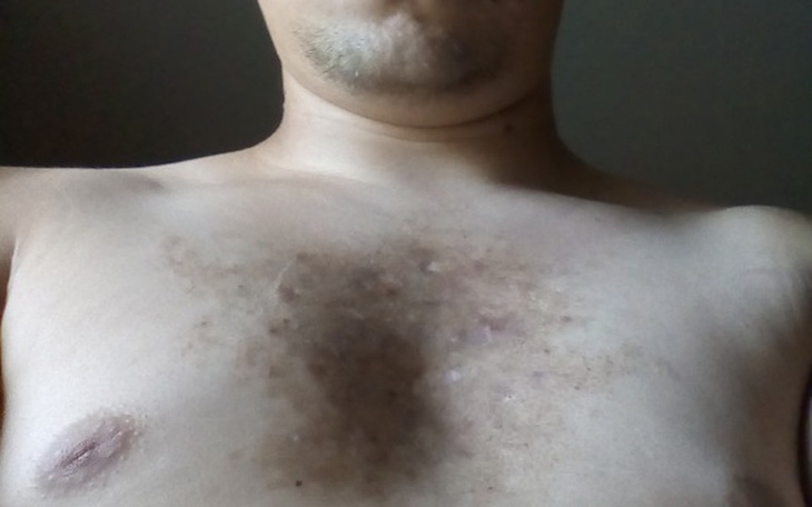 Zbiórka Operacja nowotwór - zdjęcie główne