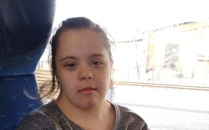 Zbiórka Paula zbiera na implanty. - zdjęcie główne