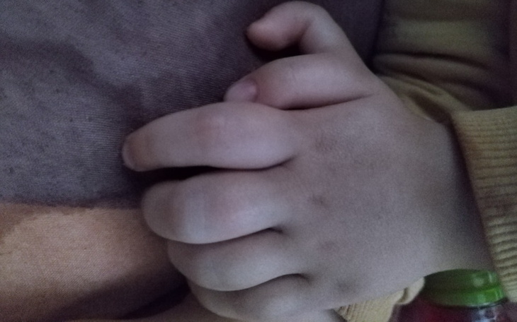 Zbiórka Zabieg chirurgiczno-plastyczno - zdjęcie główne