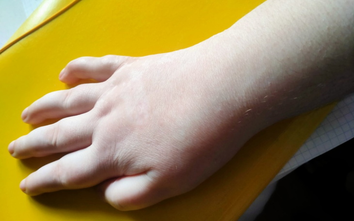 Dłoń dziecka na żółtej tekturze, z widocznymi delikatnymi włoskami.