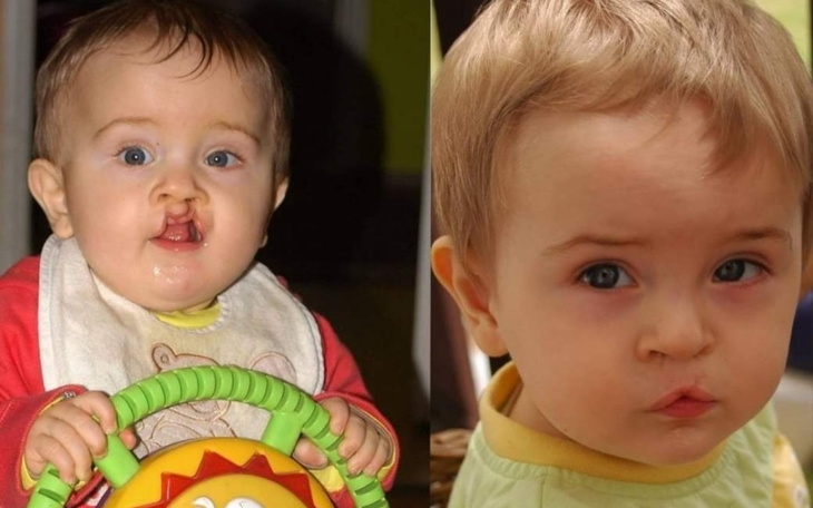 Zbiórka Leczenie i rehabilitacje. - zdjęcie główne