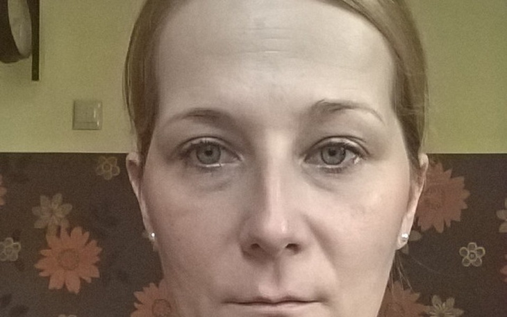 Zbiórka Rehabilitacja i rezonans - zdjęcie główne