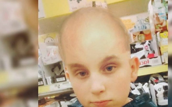 Zbiórka Przeszczep włosów dla patryka - zdjęcie główne