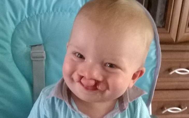 Zbiórka Wsparcie dla Ignasia - zdjęcie główne