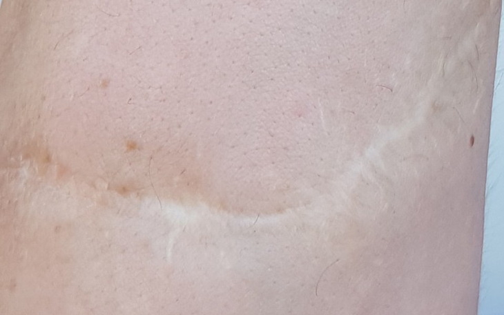 Zbiórka Wystawienie domku dla rodziny - zdjęcie główne