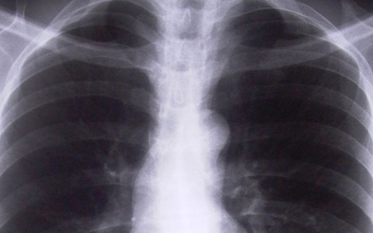 Zbiórka Błagam pomóżcie mojej cioci - zdjęcie główne