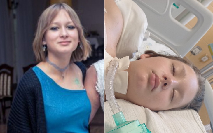 Porównanie zdjęcia przed i po hospitalizacji.