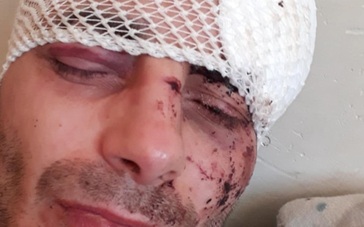 Mężczyzna z opatrunkiem na głowie, po urazie.