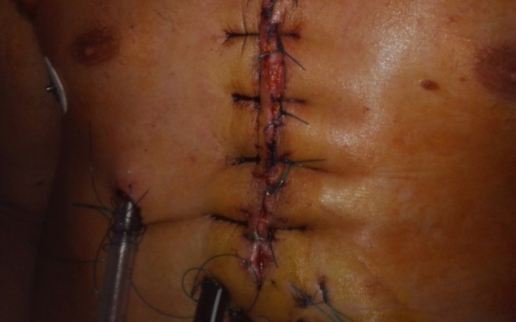 Zbiórka Leki i dobro dzieci - zdjęcie główne