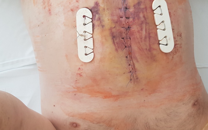 Zbiórka Zmiany nowotworowe, wodniak - zdjęcie główne