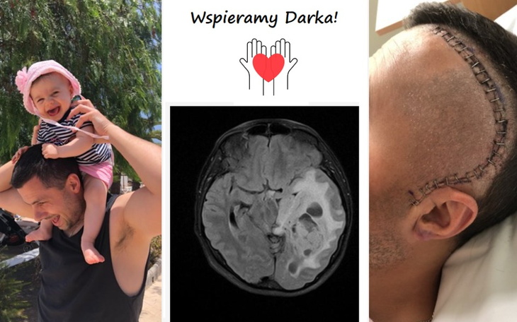 Zbiórka Zbiórka na leczenie Darka - zdjęcie główne