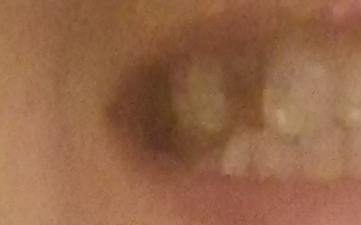 Zbiórka Na piękny i zdrowy uśmiech - zdjęcie główne