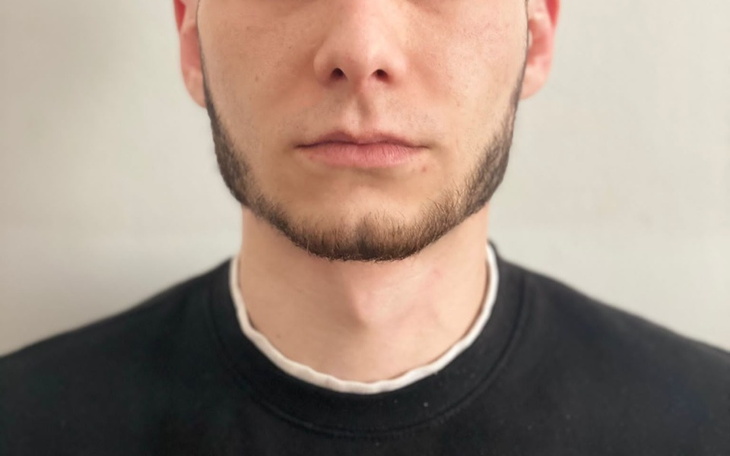 Zbiórka Dobry dzień. Potrzebuję pomocy f - zdjęcie główne