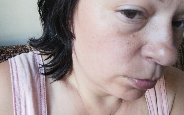 Zbiórka Na operację jaskry - zdjęcie główne