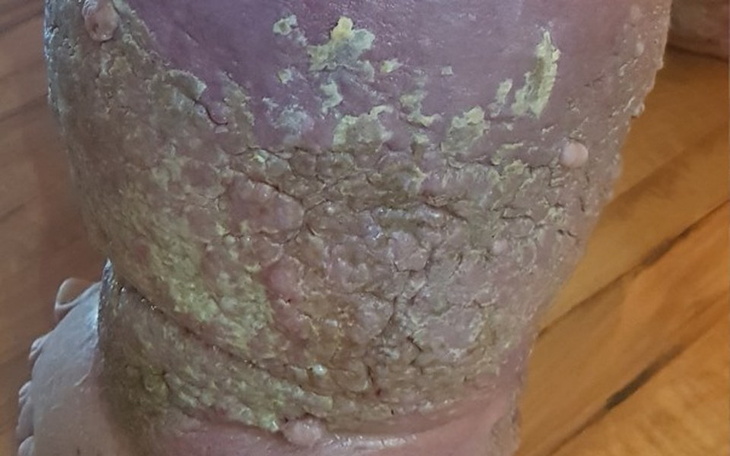 Zbiórka By uratować nogi.. - zdjęcie główne