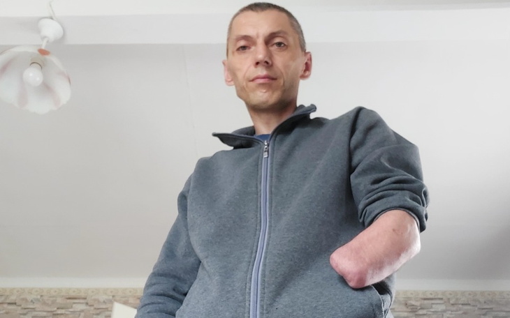 Zbiórka Proteza na lewą rękę po wypadku - zdjęcie główne