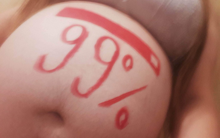 Zbiórka Dla Róży na jedzenie - zdjęcie główne