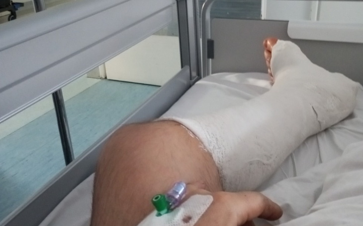 Osoba w szpitalu z opatrunkiem na nodze.