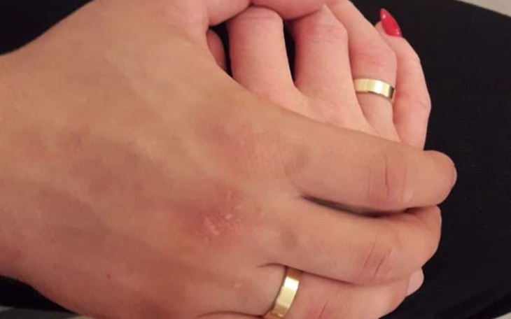 Zbiórka Korona Wirus nas rozdzielił - zdjęcie główne