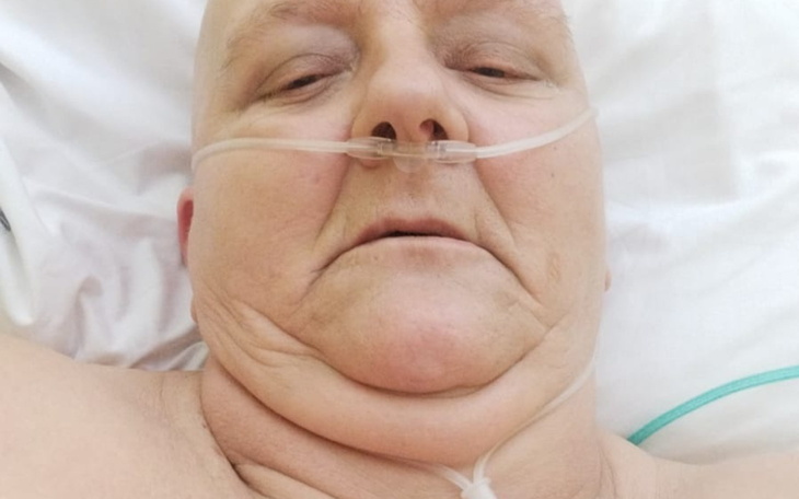 Osoba leżąca w łóżku szpitalnym z tlenem.