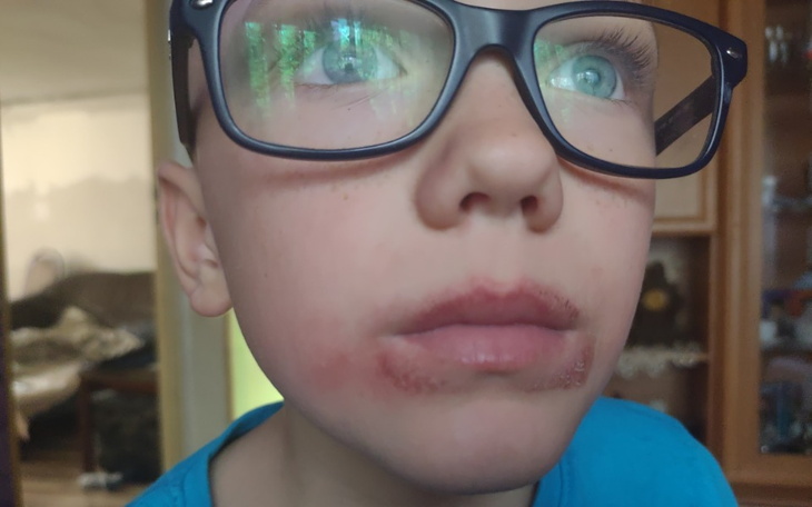 Zbiórka Pomóżmy autystycznemu Ksaweremu - zdjęcie główne