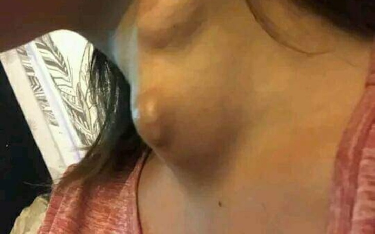 Zbiórka Pomóż Anastazji z Ukrainy - zdjęcie główne