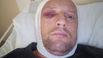 Zbiórka Pomóż nam pokonać Glejaka - miniaturka zdjęcia