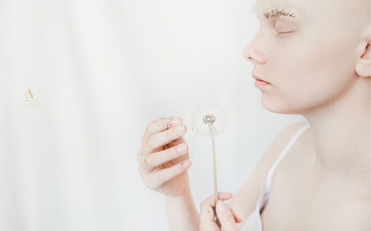 Zbiórka Włosy jak marzenie - zdjęcie główne