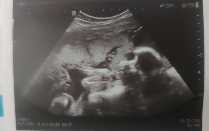 Zbiórka Potrzebna pomoc dla dzidziusia - zdjęcie główne