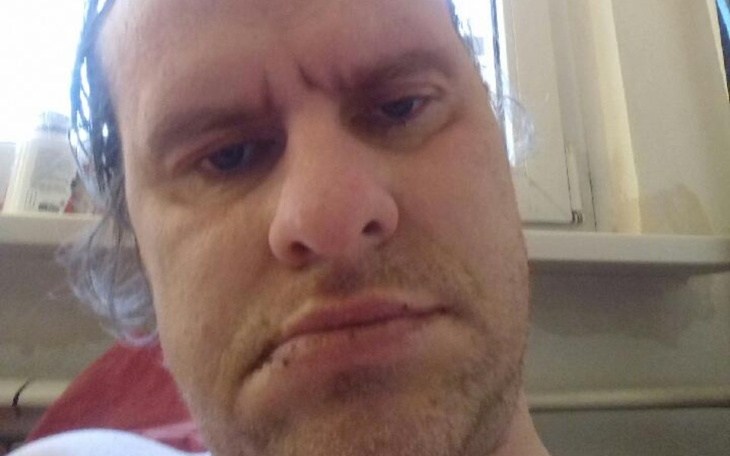 Zbiórka Glejak nowotwór mózgu pomóż mi . - zdjęcie główne