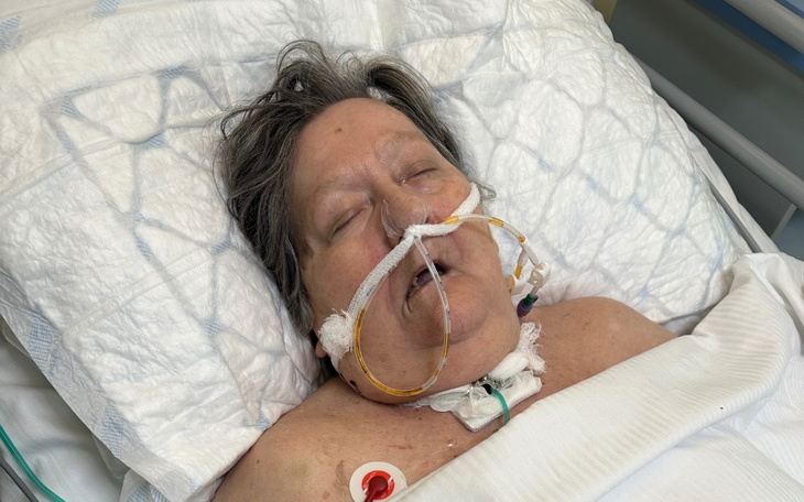 Zbiórka Błagam pomożcie mojej mamie - zdjęcie główne