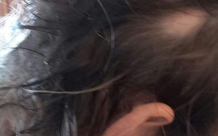 Zbiórka Chce odzyskać włosy - zdjęcie główne